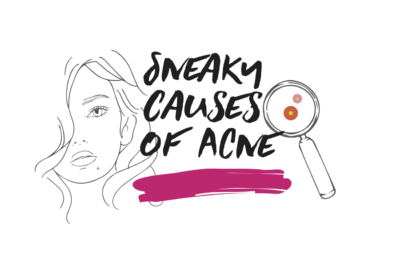 5 Sneaky Acne Culprits